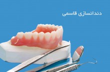 بهترین دندانسازی در مهرشهر و گلشهر کرج