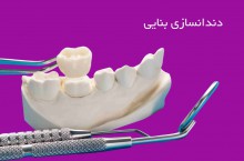 دندانسازی شمال غرب تهران